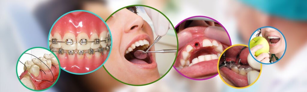 Best Dental Services in Ranchi